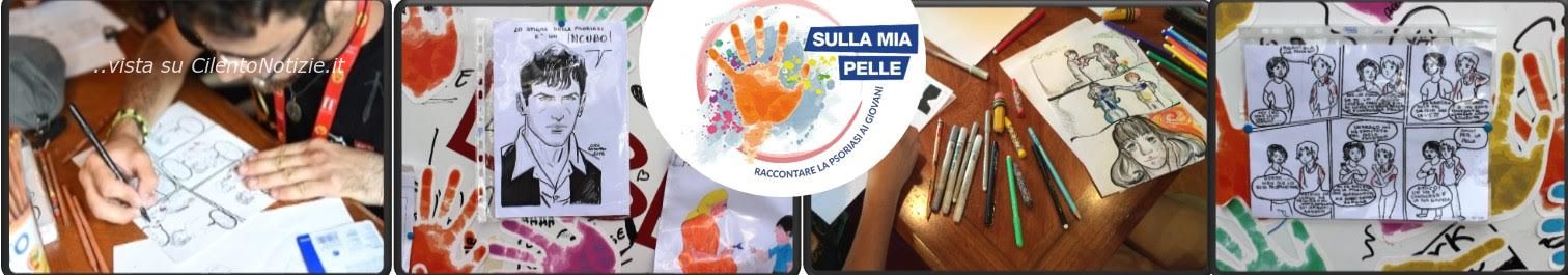 psoriasi sulla mia pelle