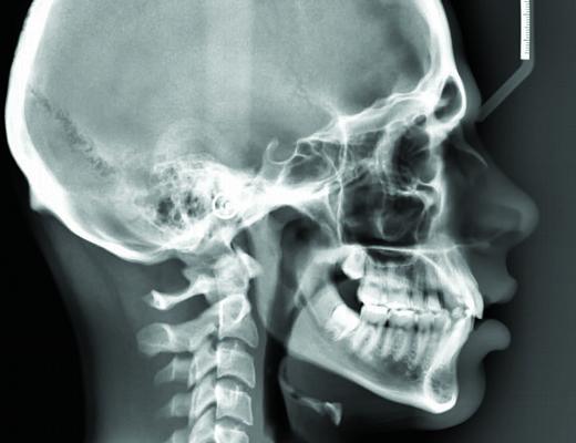 02022015 Radiologia