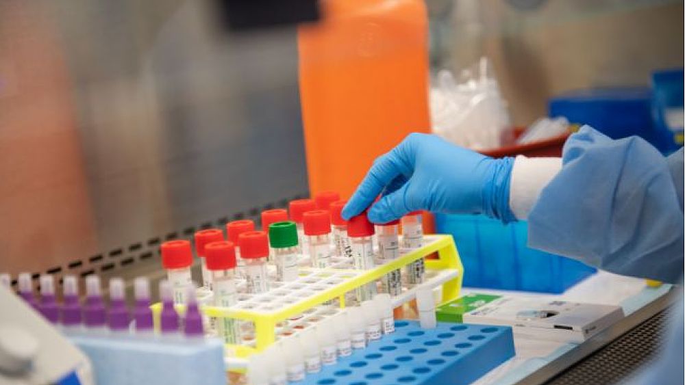 02042020 lab covid tamp 02042020 lab covid tamp