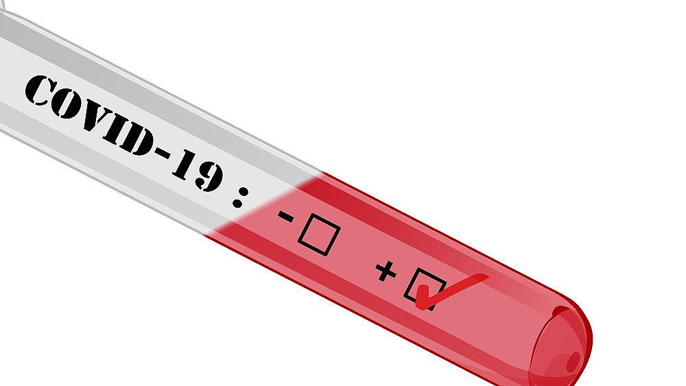 03092020 covid19 positive