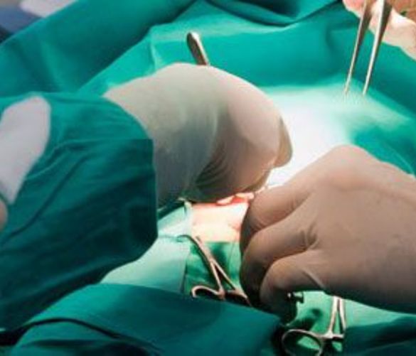 05112017 operazione chirurgica