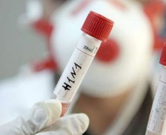 07022015 h1n1 influenza killer