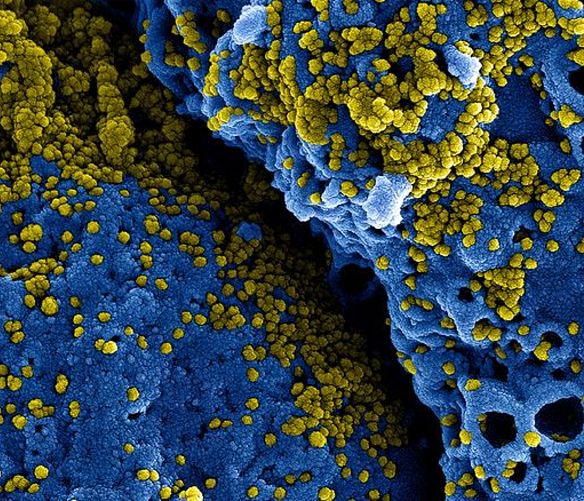 Emilio-La-Greca-Romano foto - 07052021 particelle coronavirus viste dal microscopio