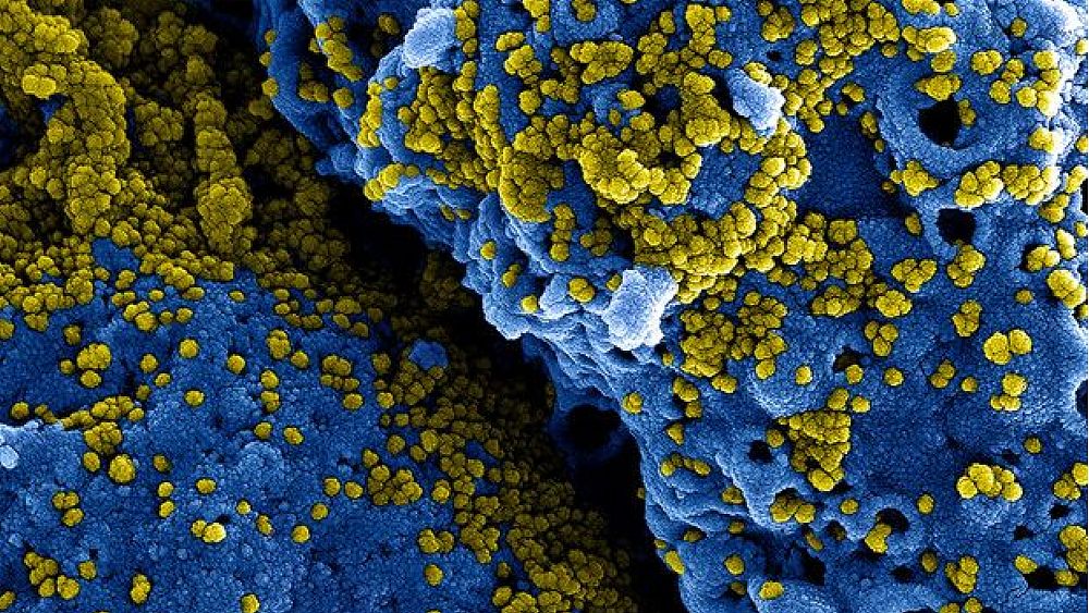 07052021 particelle coronavirus viste dal microscopio 07052021 particelle coronavirus viste dal microscopio