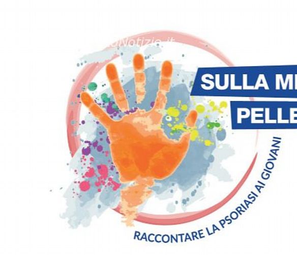 07072016 sulla mia pelle