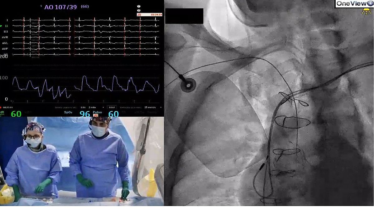 07072025 equipe cardio eboli 2 07072025 equipe cardio eboli 2