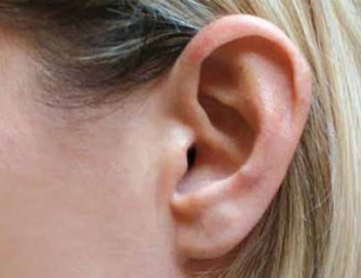 07102012 un orecchio