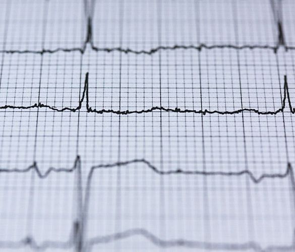 11062025 ecg cuore
