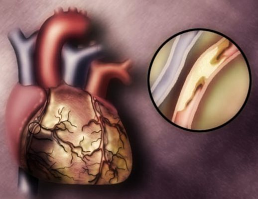 18122012 il miocardio