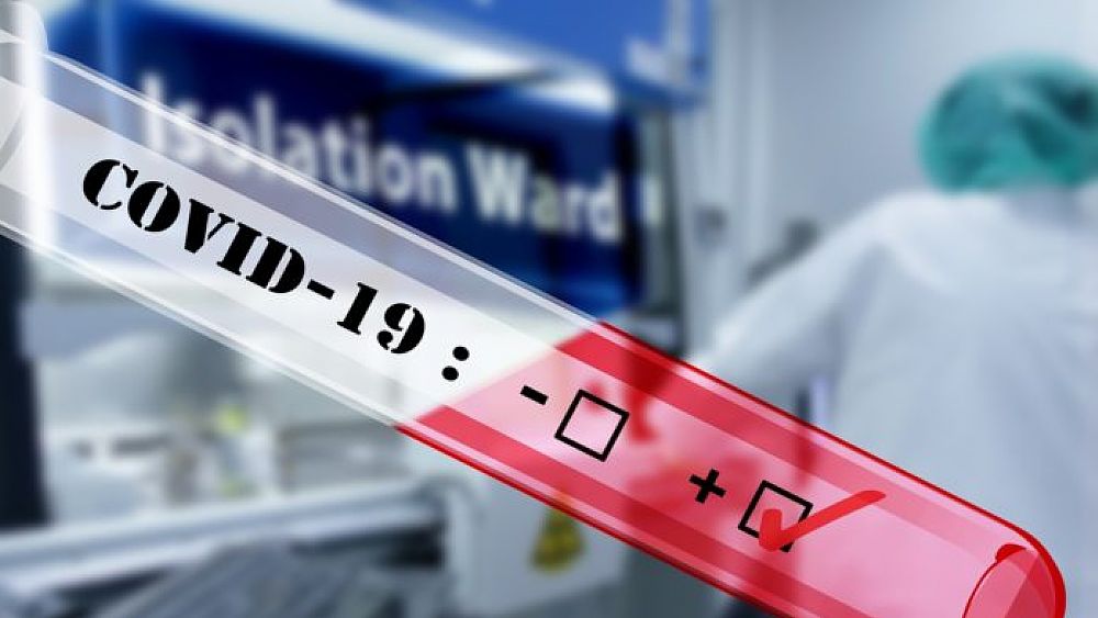 20032020 test rapido coronavirus 20032020 test rapido coronavirus