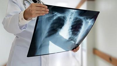 21072026 radiografia