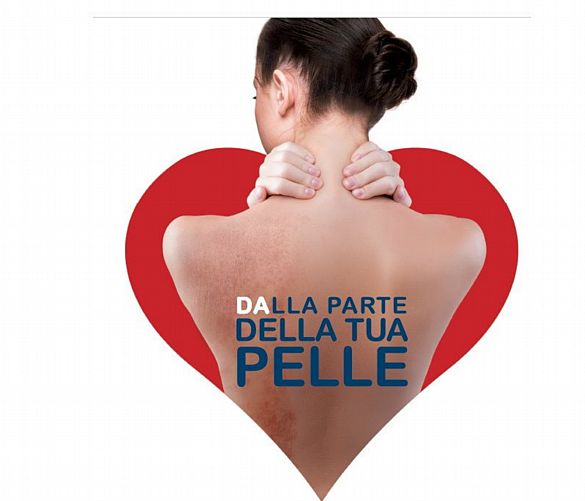 24102019 dermatite atopica