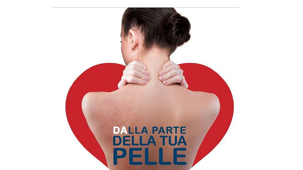 24102019 dermatite atopica