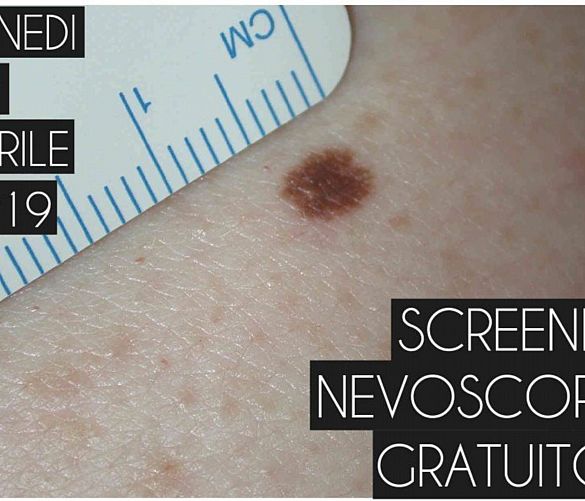 25042019 Screening nevoscopico Amalfi