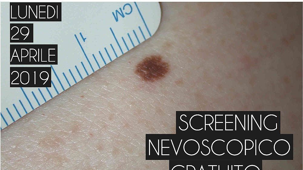 25042019 Screening nevoscopico Amalfi