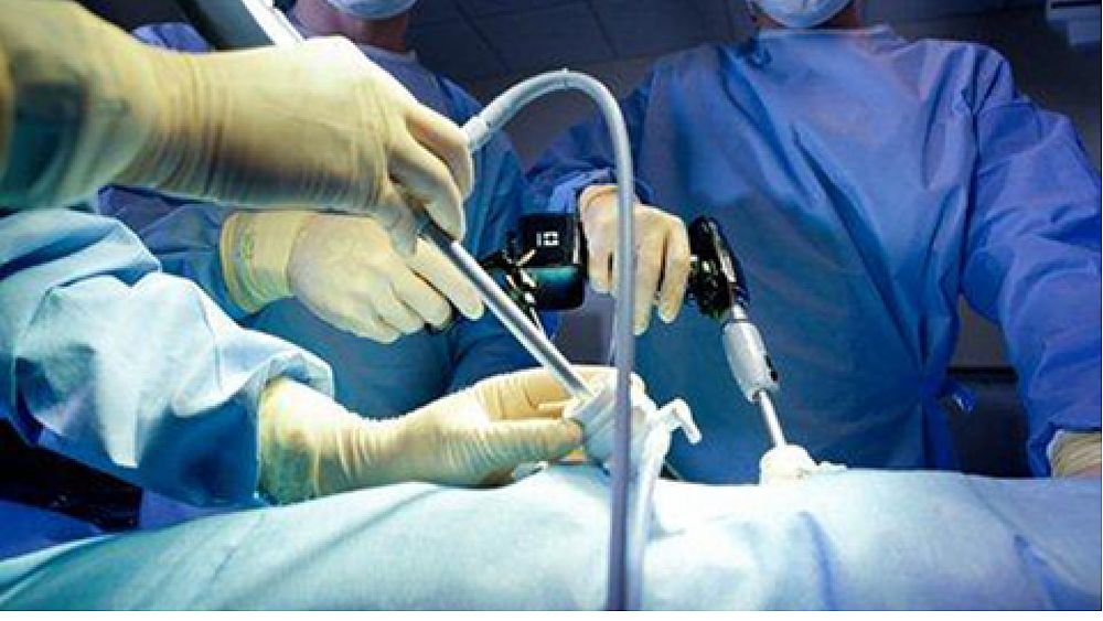 26062016 chirurgia laparoscopica