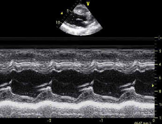 29042013 ecocardiografia neonatale