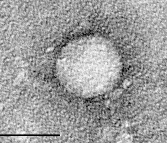 30052016 epatite c virus