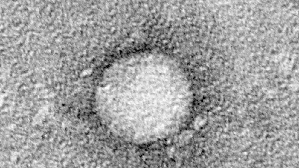 30052016 epatite c virus