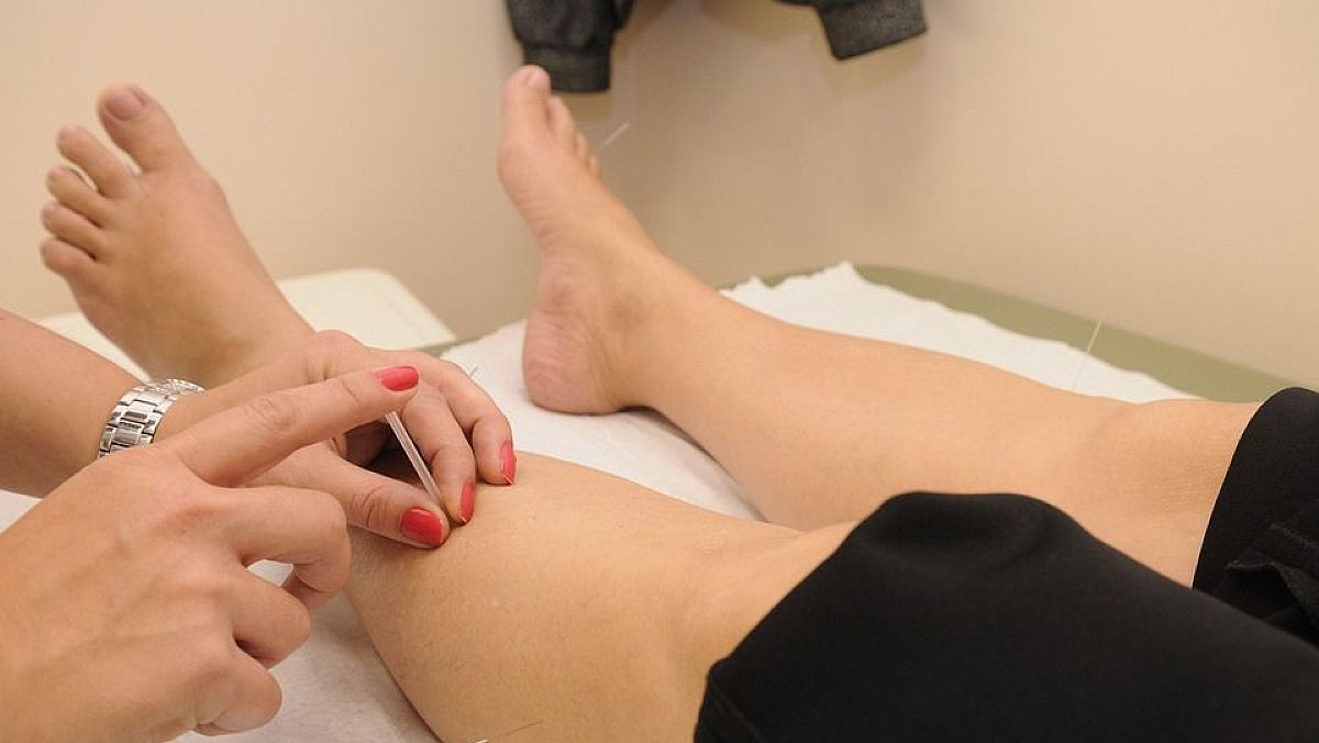 30082025 agopuntura 30082025 agopuntura