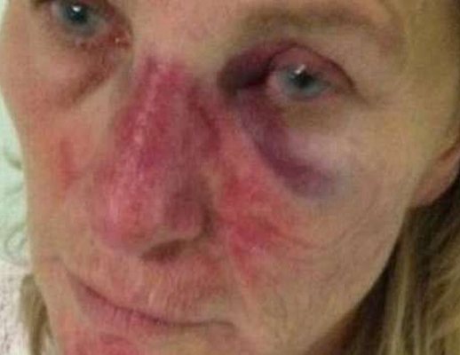 Palinuro pestaggio choc Palinuro pestaggio choc