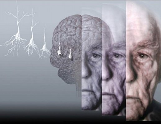 attenzione sull'Alzheimer attenzione sull'Alzheimer