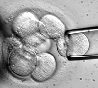 cellule staminali cellule staminali