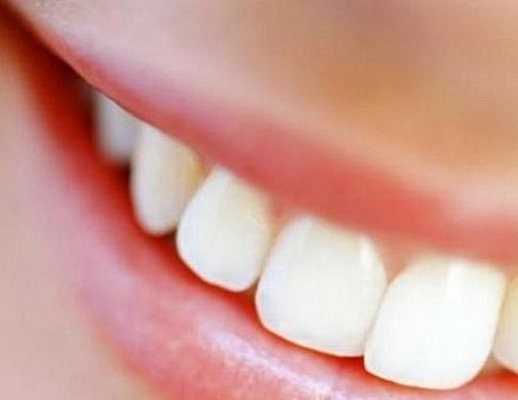 denti bianchi denti bianchi