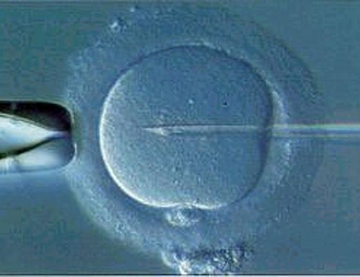 fecondazione eterologa21 fecondazione eterologa21