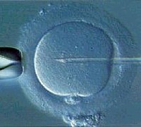 fecondazione assistita