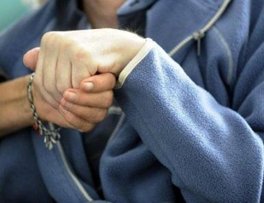 morbo di alzheimer morbo di alzheimer