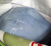 mozzarella blu esempio