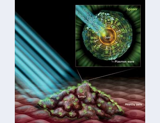 nanotecnologie theragnostic nanotecnologie theragnostic