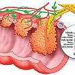 Salute foto - tumore al colon retto