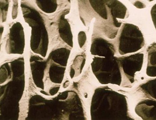 visita osteoporosi visita osteoporosi